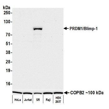 Rabbit anti-PRDM1/Blimp-1 Recombinant Monoclonal Antibody [BLR247L]
