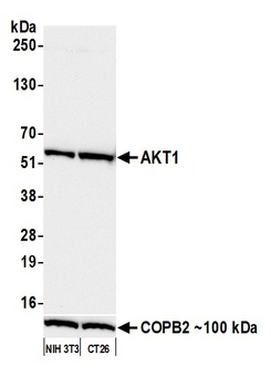 Rabbit anti-AKT1 Recombinant Monoclonal Antibody [BLR245L]
