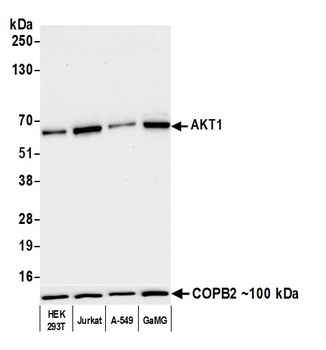 Rabbit anti-AKT1 Recombinant Monoclonal Antibody [BLR245L]