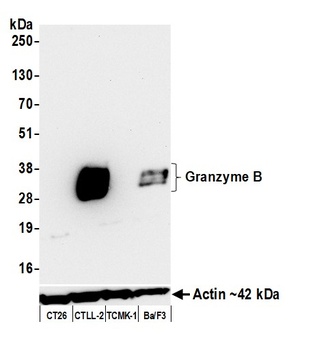 Rabbit anti-Granzyme B Recombinant Monoclonal Antibody [BLR244L]