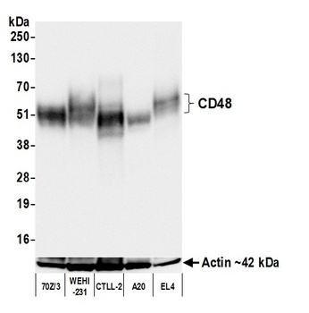 Rabbit anti-CD48 Recombinant Monoclonal Antibody [BLR275L]