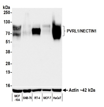 Rabbit anti-PVRL1/NECTIN1 Recombinant Monoclonal Antibody [BLR274L]