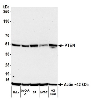 Rabbit anti-PTEN Recombinant Monoclonal Antibody [BLR270L]