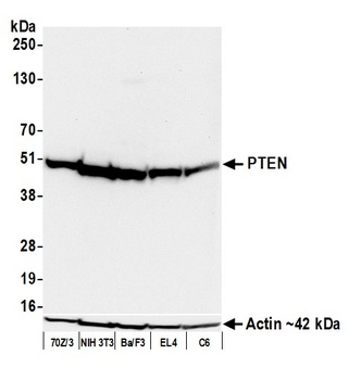 Rabbit anti-PTEN Recombinant Monoclonal Antibody [BLR270L]