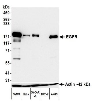 Rabbit anti-EGFR Recombinant Monoclonal Antibody [BLR252L]