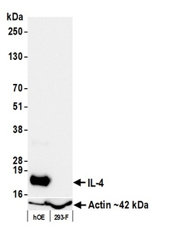 Rabbit anti-IL-4 Recombinant Monoclonal Antibody [BLR298L]