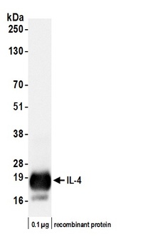 Rabbit anti-IL-4 Recombinant Monoclonal Antibody [BLR298L]