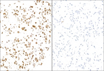 Rabbit anti-E-Selectin/CD62E Recombinant Monoclonal Antibody [BLR295L]