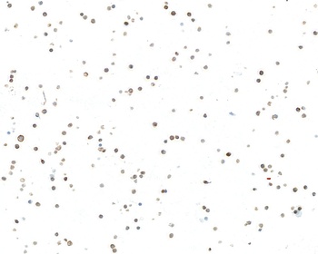 Rabbit anti-IgM Recombinant Monoclonal Antibody [BLR294L]
