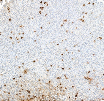 Rabbit anti-IgM Recombinant Monoclonal Antibody [BLR294L]