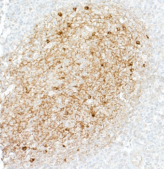Rabbit anti-IgM Recombinant Monoclonal Antibody [BLR294L]