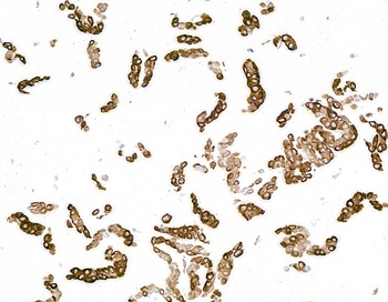 Mouse anti-Cytokeratin 14 Recombinant Monoclonal Antibody [LL002]