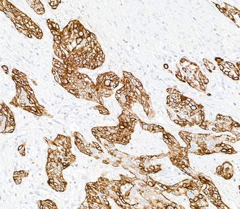 Mouse anti-Cytokeratin 14 Recombinant Monoclonal Antibody [LL002]