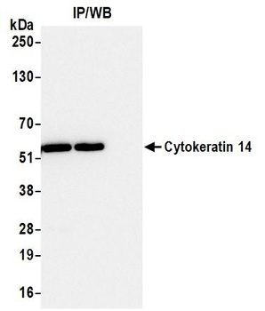 Mouse anti-Cytokeratin 14 Recombinant Monoclonal Antibody [LL002]