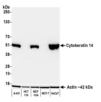 Mouse anti-Cytokeratin 14 Recombinant Monoclonal Antibody [LL002]