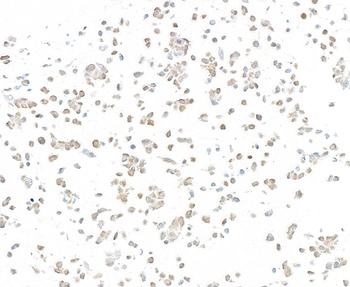 Mouse anti-p16INK4a Recombinant Monoclonal Antibody [BC42]