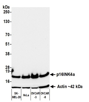 Mouse anti-p16INK4a Recombinant Monoclonal Antibody [BC42]