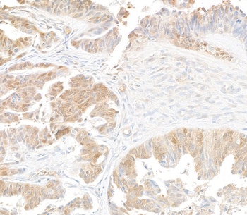 Mouse anti-p16INK4a Recombinant Monoclonal Antibody [BC42]
