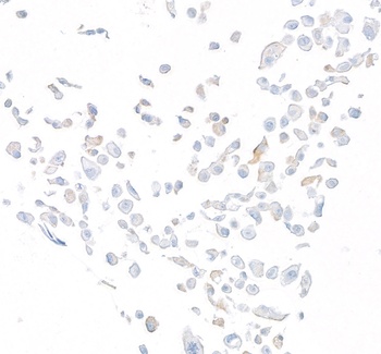 Rabbit anti-DPP4/CD26 Recombinant Monoclonal Antibody [BLR288L]