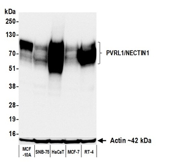 Rabbit anti-PVRL1/NECTIN1 Recombinant Monoclonal Antibody [BLR284L]