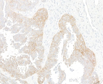 Rabbit anti-Met Recombinant Monoclonal Antibody [BLR283L]