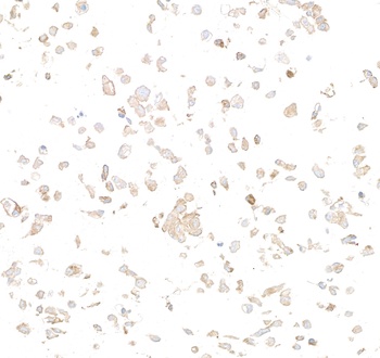 Rabbit anti-Met Recombinant Monoclonal Antibody [BLR283L]