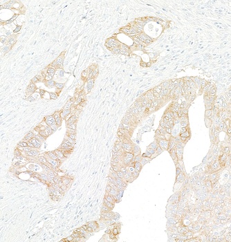Rabbit anti-Met Recombinant Monoclonal Antibody [BLR283L]