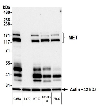 Rabbit anti-Met Recombinant Monoclonal Antibody [BLR283L]