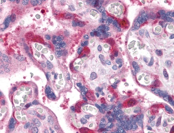 RIPK1 Antibody