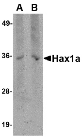 Hax1a Antibody [9F3D11]