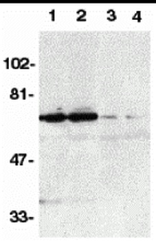 DR6 Antibody