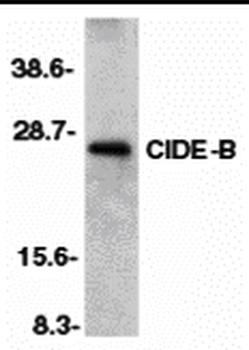 CIDE-B Antibody