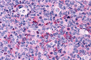 Caspase-3 Antibody