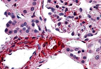 CARMA3 Antibody
