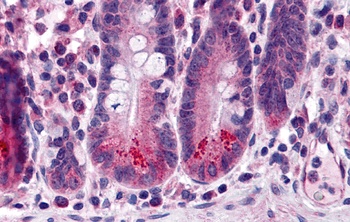 BRUCE Antibody