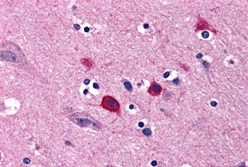 BOK Antibody