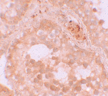 WDR92 Antibody