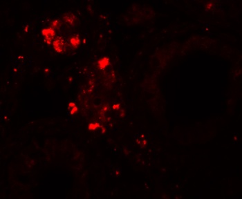 WDR92 Antibody