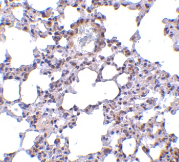 TRPC6 Antibody