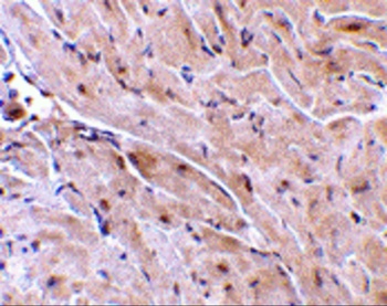 TRIAD3A Antibody