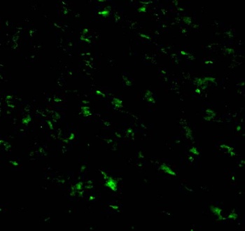 TRIAD3A Antibody