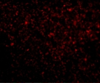 TREX1 Antibody