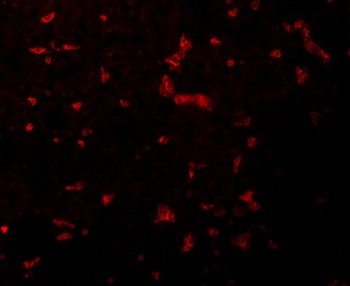 RIPK1 Antibody