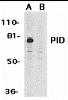 PID Antibody