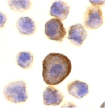 PERP Antibody
