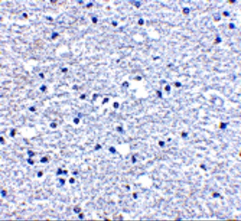 PD-1 Antibody