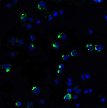 PD-1 Antibody