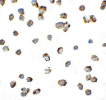 PD-1 Antibody