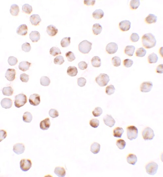 TIAF Antibody