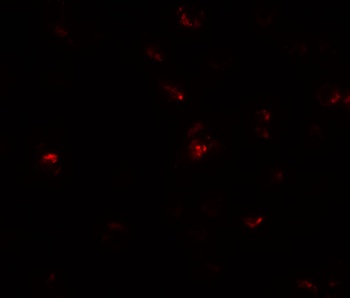 TGM7 Antibody